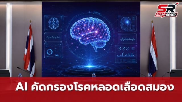 กรมการแพทย์ ผนึกกำลัง สกสว. และ สไกน์ เมด พัฒนา AI อัจฉริยะคัดกรองโรคหลอดเลือดสมอง